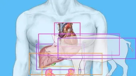 الصين.. استخلاص نتائج سريرية بعد زرع كبد وكلية خنزير في جسم إنسان لمدة 5 أيام