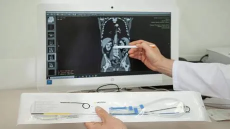 علماء روس يبتكرون طريقة لتشخيص أمراض المسالك البولية باستخدام الهاتف الذكي