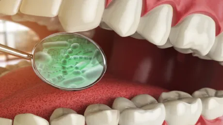 "علكة مبتكرة" تستهدف ميكروبات الفم المسببة للسرطان