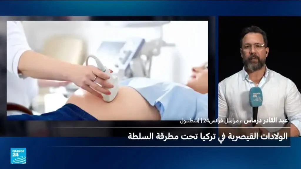 جدل في تركيا بعد توقيف 100 طبيب بسبب ارتفاع الولادات القيصرية