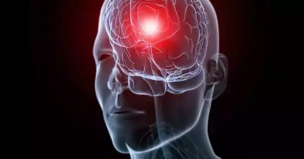 مسمار يخترق عين رجُل ويستقر في دماغه مسمار يخترق عين رجُل ويستقر في دماغه