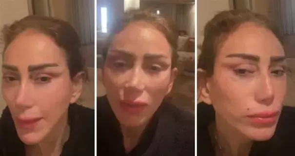 التجميل يشوه ريهام سعيد التجميل يشوه ريهام سعيد